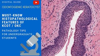 Odontogenic Keratocyst Histopathology [upl. by Graff]