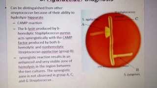 Camp reaction for diagnosing streptococcus agalactiae [upl. by Seward]