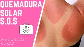 GUÍA RÁPIDA en caso de QUEMADURA SOLAR 🔆 [upl. by Hasin597]