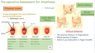 Preoperative Assessment for Anesthesia  Health Hush [upl. by Llegna577]