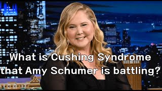 What is Cushing Syndrome that Amy Schumer is battling [upl. by Laamak93]