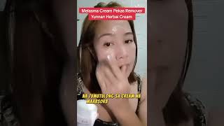 Melasma Cream  Sale Off 40 [upl. by Annaig]