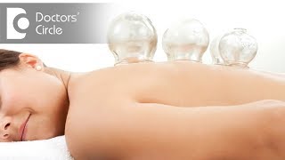 What is Cupping Therapy  Dr Shagufta Siraj [upl. by Min]