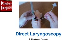 Direct Laryngoscopy [upl. by Berenice553]