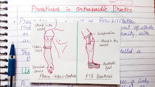 Prosthesis in Orthopaedic Practice  uses parts of prosthesis [upl. by Ciapas]