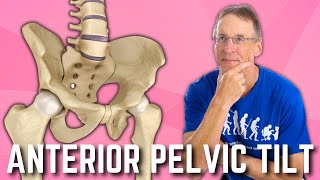 Anterior Pelvic Tilt Do You Have It How to Fix A BIG SURPRISE [upl. by Benildis873]