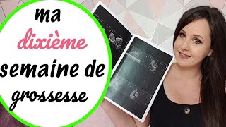 🍼 10ème semaine de grossesse échographie du premier trimestre  vidéo écho [upl. by Arola]