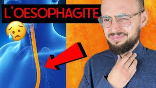 ŒSOPHAGITE  causes symptômes et traitements [upl. by Darius]