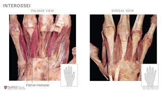 Anatomy of the Upper Limb Interossei and Lumbricals [upl. by Iphlgenia67]