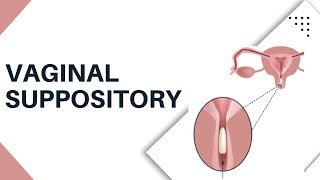 Vaginal Suppository Insertion  How to put It Safely and Easily [upl. by Linis]