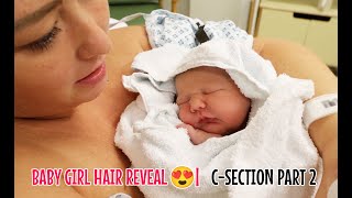 BABY GIRL HAIR REVEAL 😍  CSECTION DELIVERY PART 2 [upl. by Etteroma]