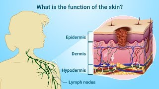 Understanding Melanoma [upl. by Nudnarb]