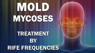 Mold and Mycoses Fungus Diseases  RIFE Frequencies Treatment  Energy amp Quantum Medicine [upl. by Rosemarie]