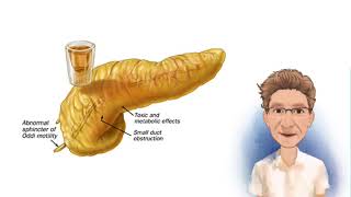 FISIOPATOLOGÍA DE LA PANCREATITIS [upl. by Moseley]