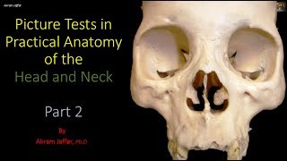 Bones of the skull and more skull anatomy [upl. by Aleac]