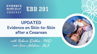 Evidence on Skin to Skin Care after a Cesarean [upl. by Leugim]