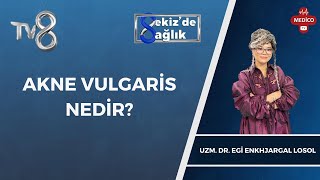 Akne Vulgaris Nedir  Uzm Dr Egi Enkhjargal Losol  8de Sağlık [upl. by Lainahtan]