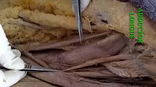 DISSECTION OF FRONT OF THIGH PART1 BY DR MITESH DAVE [upl. by Traver]