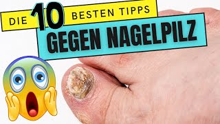 Die 10 besten TIPPS gegen NAGELPILZ  Wie du deinen NAGELPILZ endlich loswirst [upl. by Rodina]