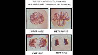 QUICK GUIDE TO ONION ROOT TIP CELL DIVISION STAGES PROPHASE METAPHASE ANAPHASE amp TELOPHASE [upl. by Ledua]