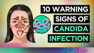 10 Symptoms of CANDIDA OVERGROWTH Yeast Infection [upl. by Mariann]