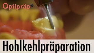 Tutorial Hohlkehlpräparation mit Optipräp® [upl. by Jadd]