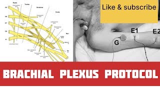 Brachial plexus study  NCS of brachial plexus [upl. by Cheng718]