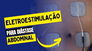 Eletroestimulação para diastase abdominal [upl. by Hpesojnhoj]