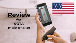 NOTA review Personal mole tracker [upl. by Hymen]