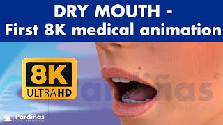 DRY MOUTH  Causes and remedies of xerostomia  WORLDS FIRST MEDICAL ANIMATION IN 8K © [upl. by Arayk372]