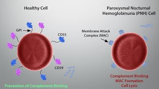 Laboratory Features of Paroxysmal Nocturnal Hemoglobinuria [upl. by Annwahs]