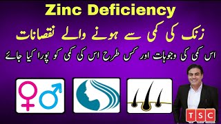 Zinc Deficiency Symptoms And Treatment  Zinc deficiency ki kami ka jadeed ilaj  in Urdu  Hindi [upl. by Icart420]