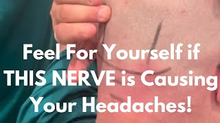 How to Check To See if Your Chronic headache is Coming from an Occipital Nerve Entrapment [upl. by Aikrahs207]