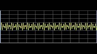 Q Fever Coxiella burnetiiRickettsia  Rife Frequencies [upl. by Oaoj]