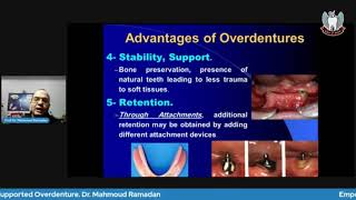 Tooth Supported Overdenture Part 1 Advantages Disadvantages Indications amp Contraindications [upl. by Nanice]