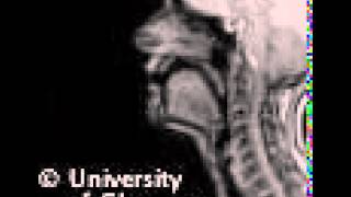 MRI voiced alveolar trill [upl. by Hinson]