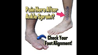 After Ankle Sprain and Surgery Check Your Foot Alignment [upl. by Airliah]