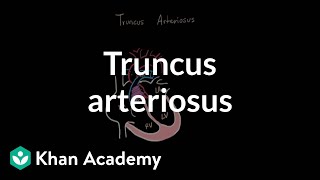 Truncus arteriosu  Circulatory System and Disease  NCLEXRN  Khan Academy [upl. by Karlie325]