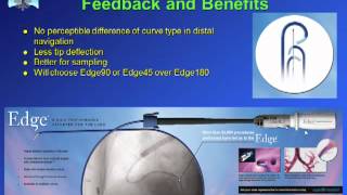 Navigational Bronchoscopy for the Solitary Pulmonary Nodule [upl. by Terrena960]