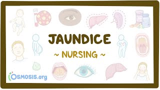 Jaundice Clinical Nursing Care [upl. by Sahcnip]