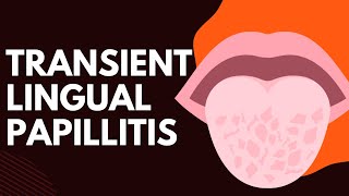 Transient Lingual Papillitis 5 Definitive Symptoms [upl. by Hollingsworth]