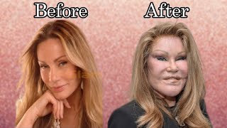 The Story Of JOSELYN WILDENSTEIN aka Cat woman  Plastic Surgery Billionaire marriage and more [upl. by Assetan]