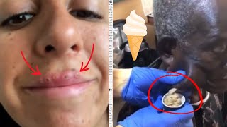 Ultimate Blackhead Removal Compilation 2024 Satisfying Extractions and Perfect Skin Tips [upl. by Caprice717]