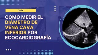 🧐Cómo Medir el 🎯DIÁMETRO DE LA VENA CAVA INFERIOR por Ecocardiografía Paso a paso [upl. by Libbey]