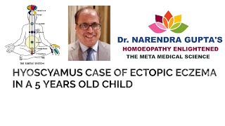 HYOSCYAMUS CASE OF ECTOPIC ECZEMA IN A 5 YEARS OLD CHILD [upl. by Sancha199]