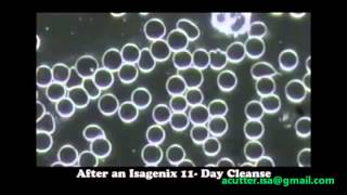 Isagenix blood cells before and after cleanse video Live blood analysis [upl. by Ayak]