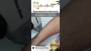 Depilación Láser para Piernas Completas depilacionlaser hairremoval depilacionlaserdiodo [upl. by Gneh]