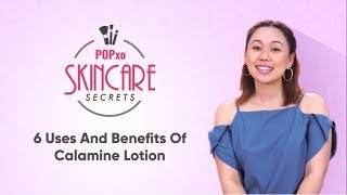 6 Uses And Benefits Of Calamine Lotion  POPxo Skincare Secrets [upl. by Ynnoj]