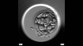 Embryots utveckling dag 0 till dag 5 [upl. by Ahsiemak663]