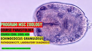 Echinococcus granulosus Pathogenicity and Laboratory Diagnosis [upl. by Colbert]